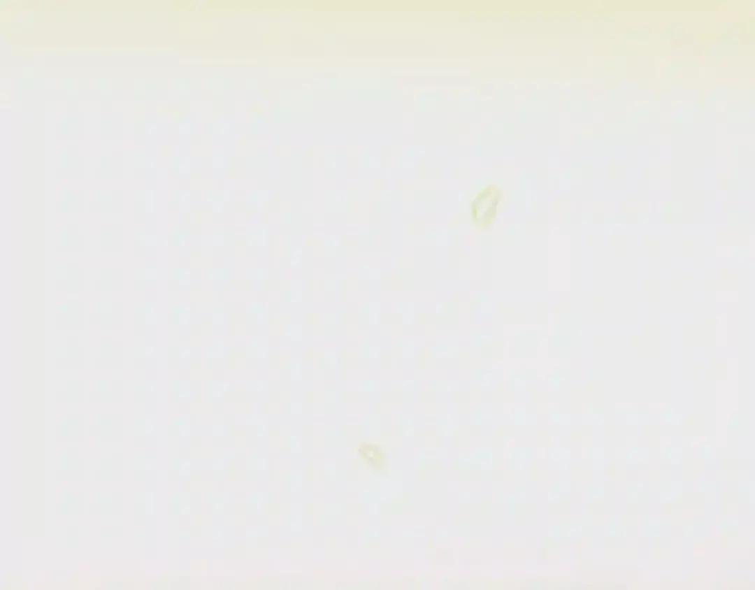 第38话 你是我的祝福吗?