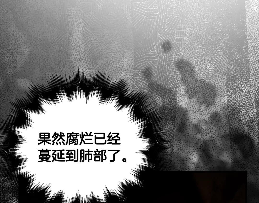 第5话 手术成功