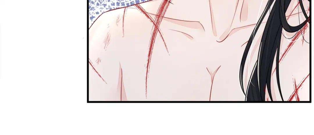 第22话 疼，师叔