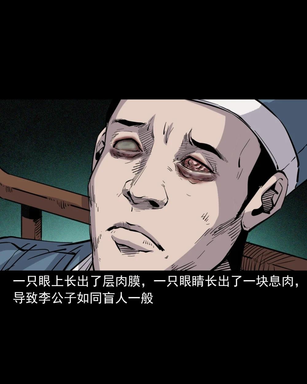 113 第113话双瞳