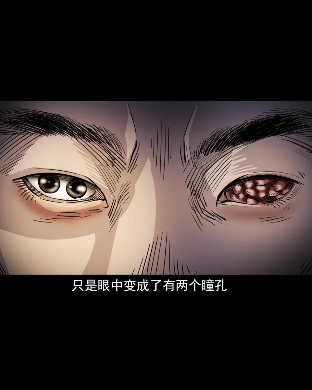 113 第113话双瞳