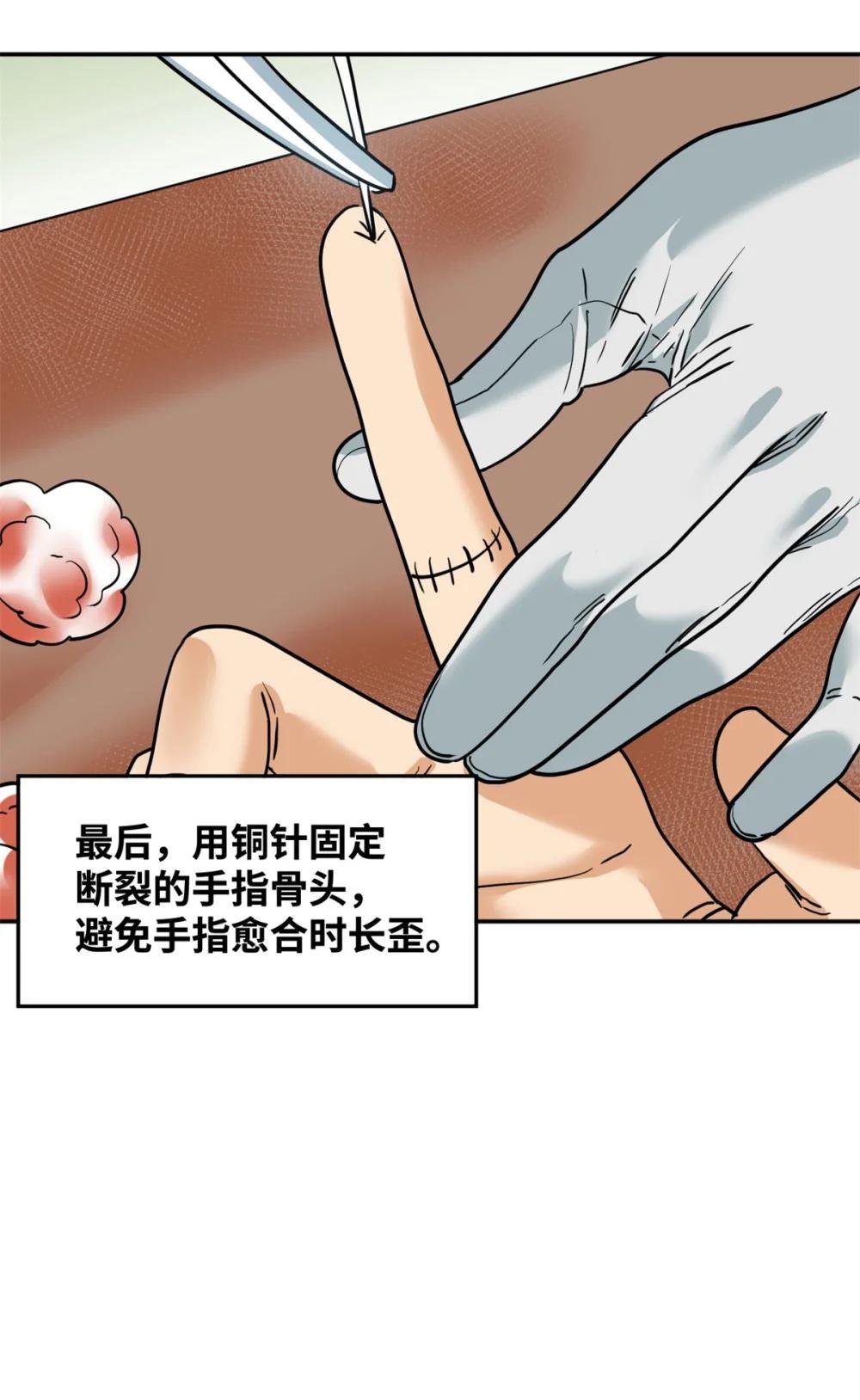 269 接掌手术